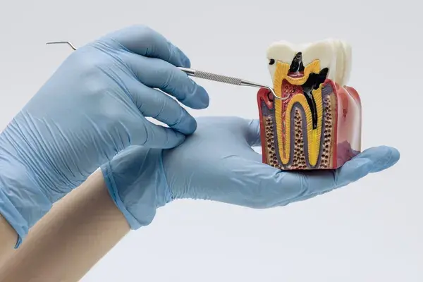 Endodoncia