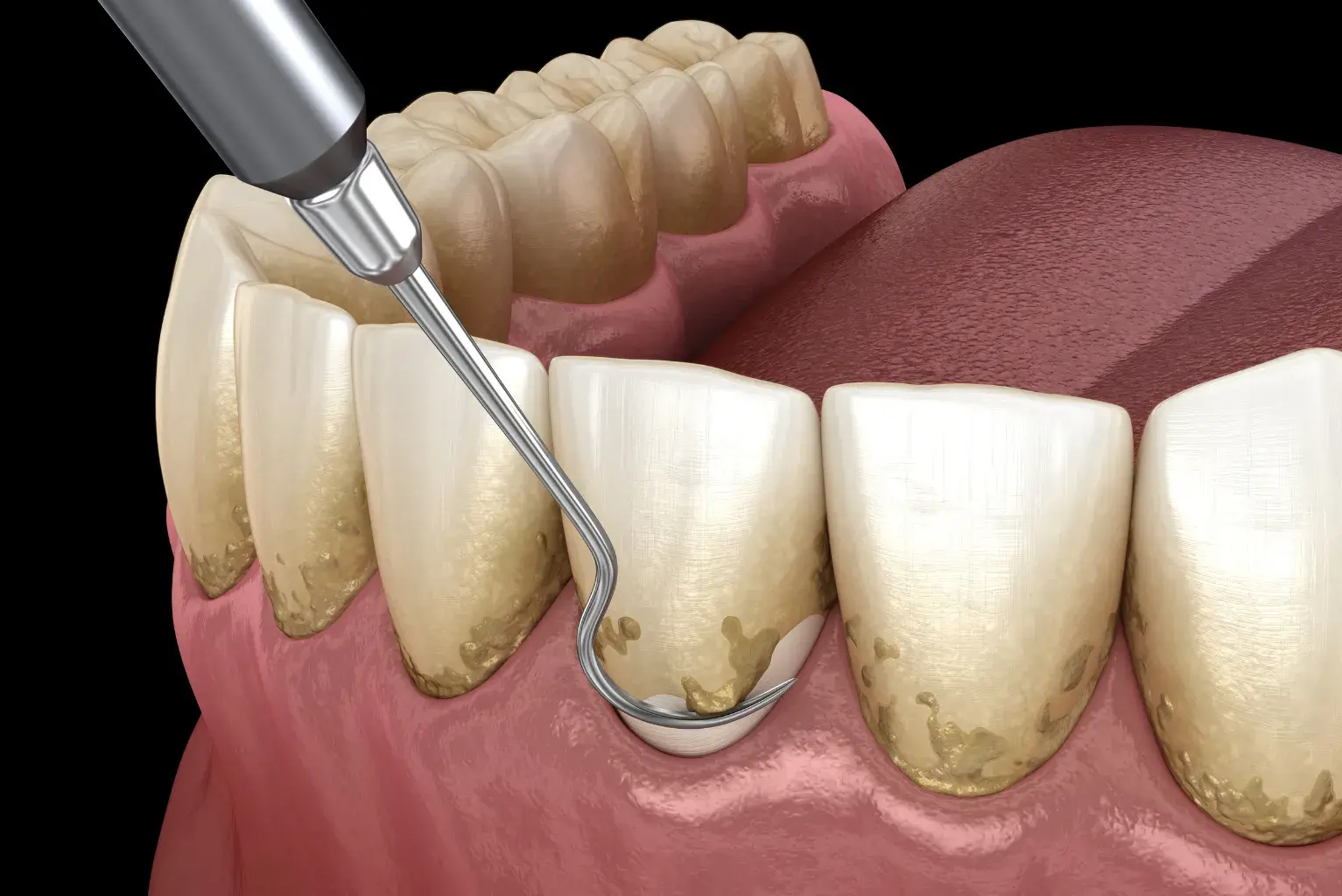 Clínica Dental Calvarro