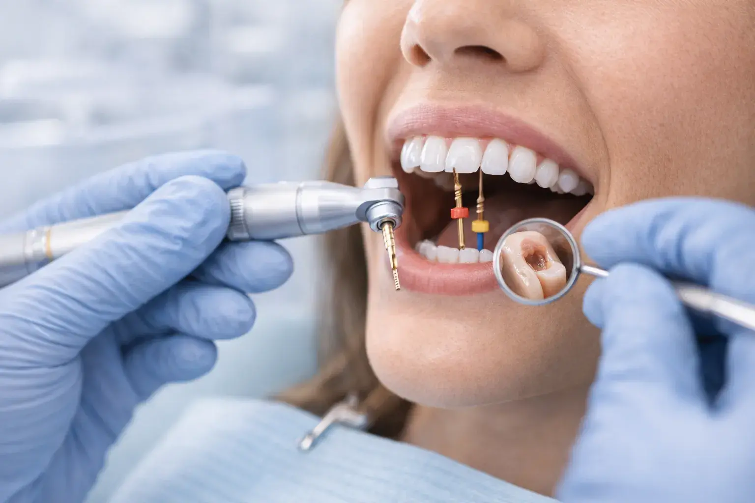 Endodoncia