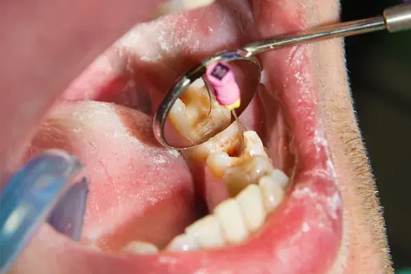 Clínica Dental Calvarro