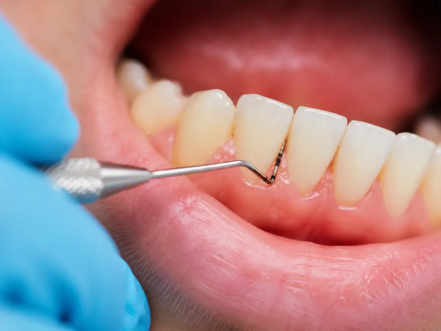 Clinica Dental Calvarro